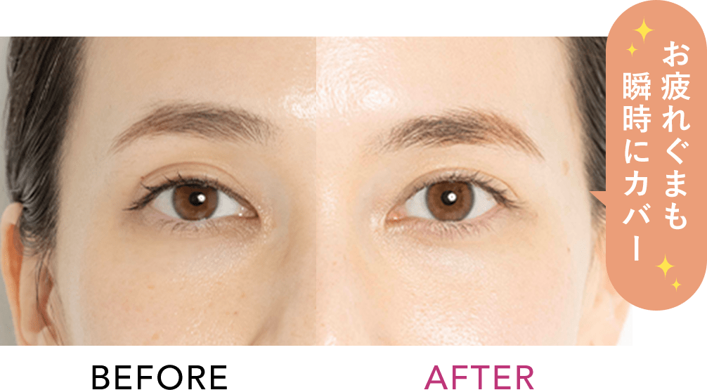 BEFORE AFTER