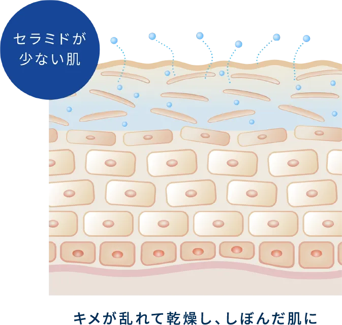 セラミドが少ない肌 キメが乱れて乾燥し、しぼんだ肌に
