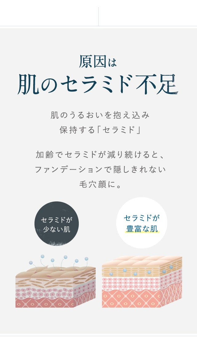 原因は肌のセラミド不足