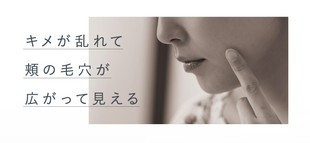 キメが乱れて頬の毛穴が広がって見える